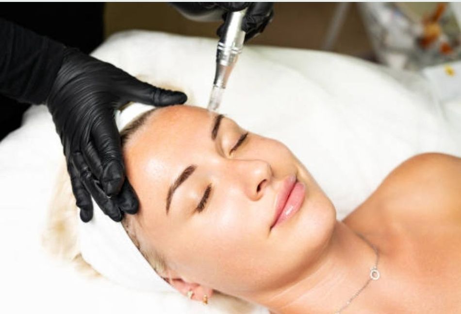 Tratamiento con Dermapen para renovación de piel