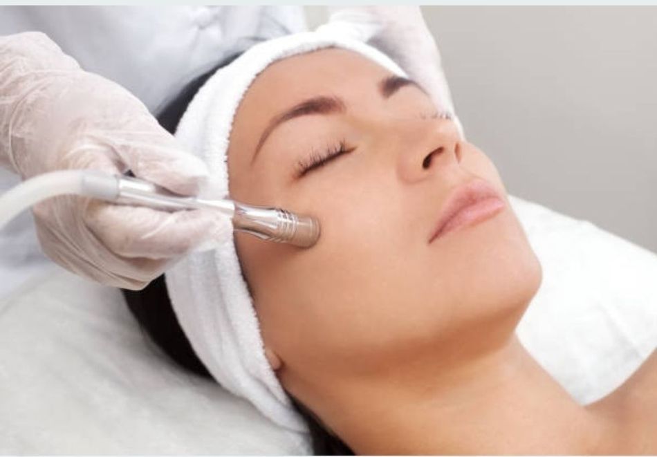 Sesión de microdermoabrasión facial